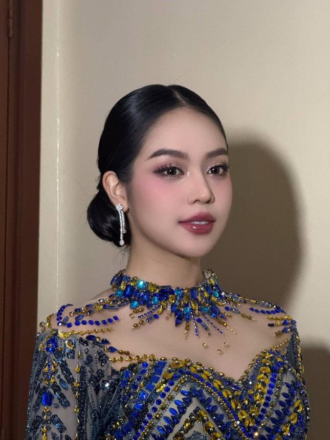 post-image-hoa-hau-thanh-thuy-nhap-vien-tai-indonesia-tinh-trang-suc-khoe-hien-tai